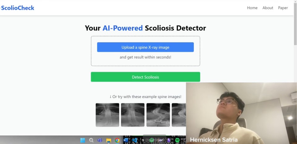 ScolioVis